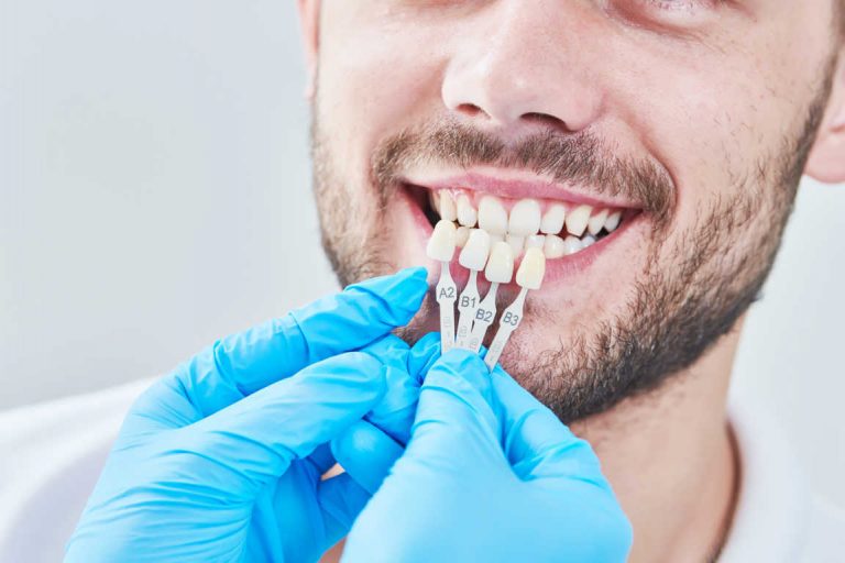 Los nuevos tratamientos en estética dental